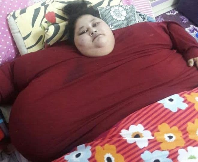 Eddig mintegy 325 kilogrammot fogyott a világ legkövérebb nője