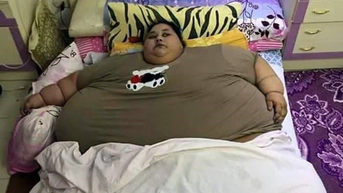 Újabb 65 kilogrammot fogyott a világ legkövérebb nője