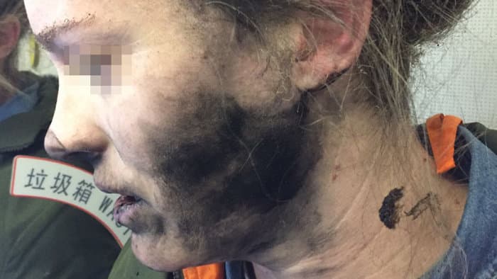 PÁNIK A REPÜLŐGÉPEN: Egy nő fülén felrobbant a fülhallgató