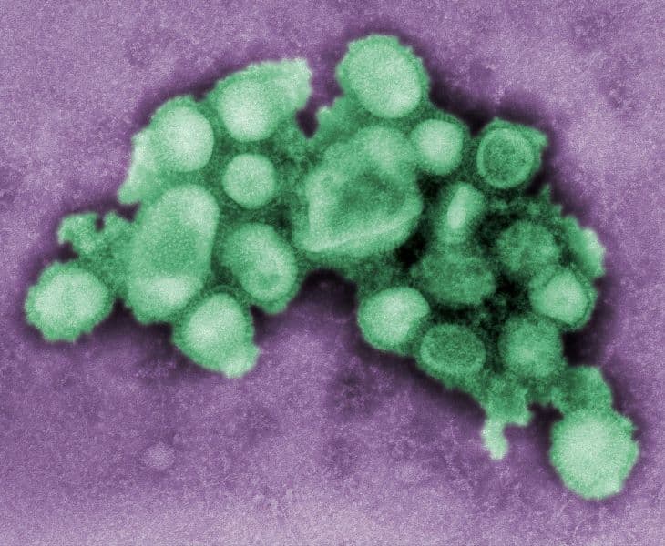 Csaknem 90 százalékkal emelkedett az influenzások száma Nagyszombat megyében