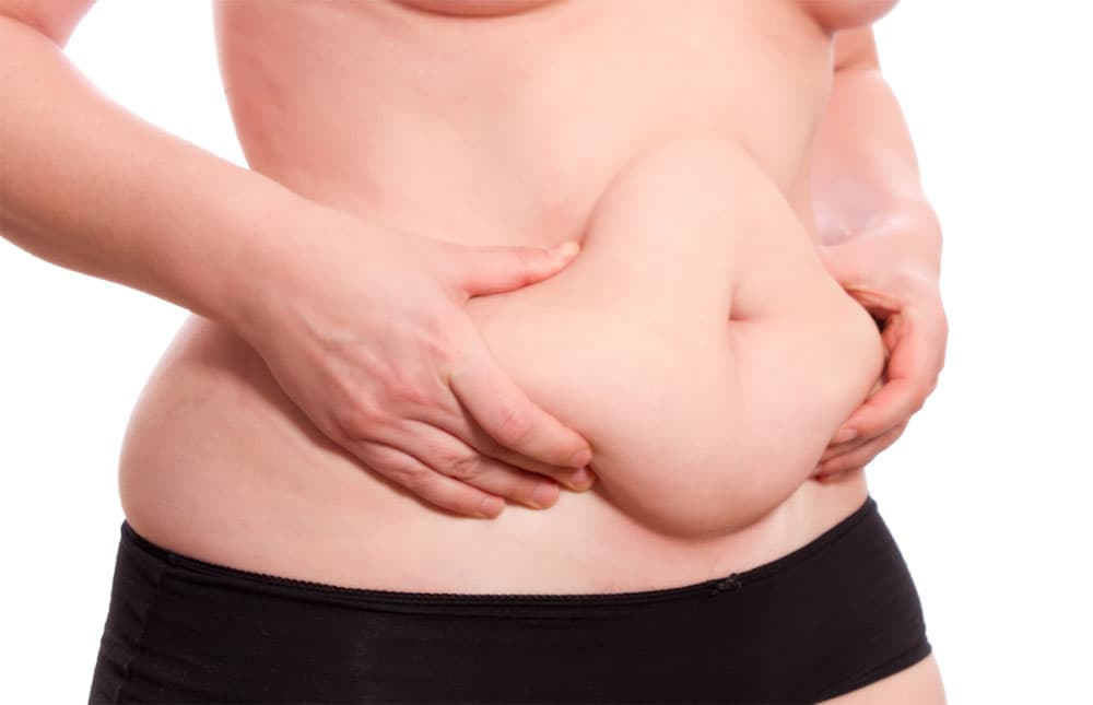 Támad a daganat: 25 év múlva elhízás miatt több brit nő lesz rákos, mint a dohányzás miatt