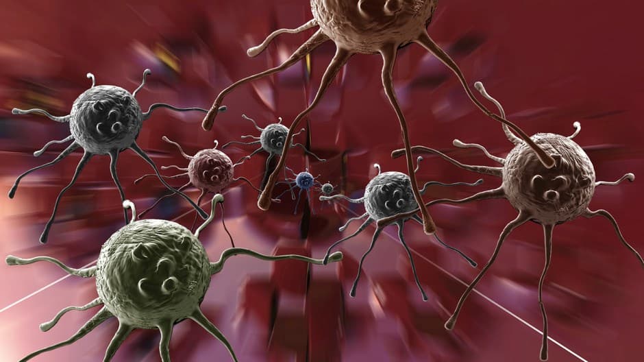Mágneses óriásrobotot vetnek be a rákos sejtek ellen