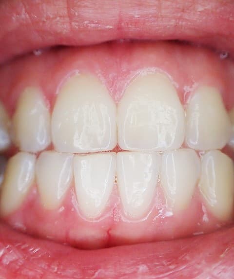 Ez a nő szokatlan fogsorral rendelkezik, aminek nagyon egyszerű oka van (FOTÓK)